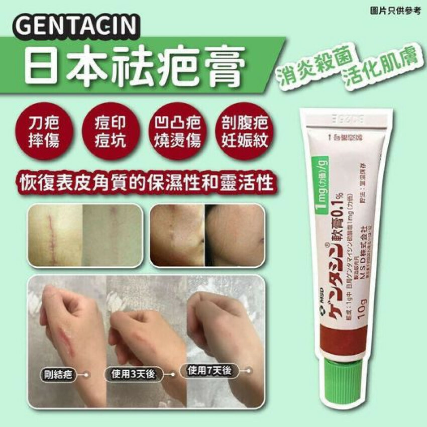 現 貨 日 本 直 送丨🇯🇵日本 MSD去疤膏10G 💯日本最好的祛疤凝胶