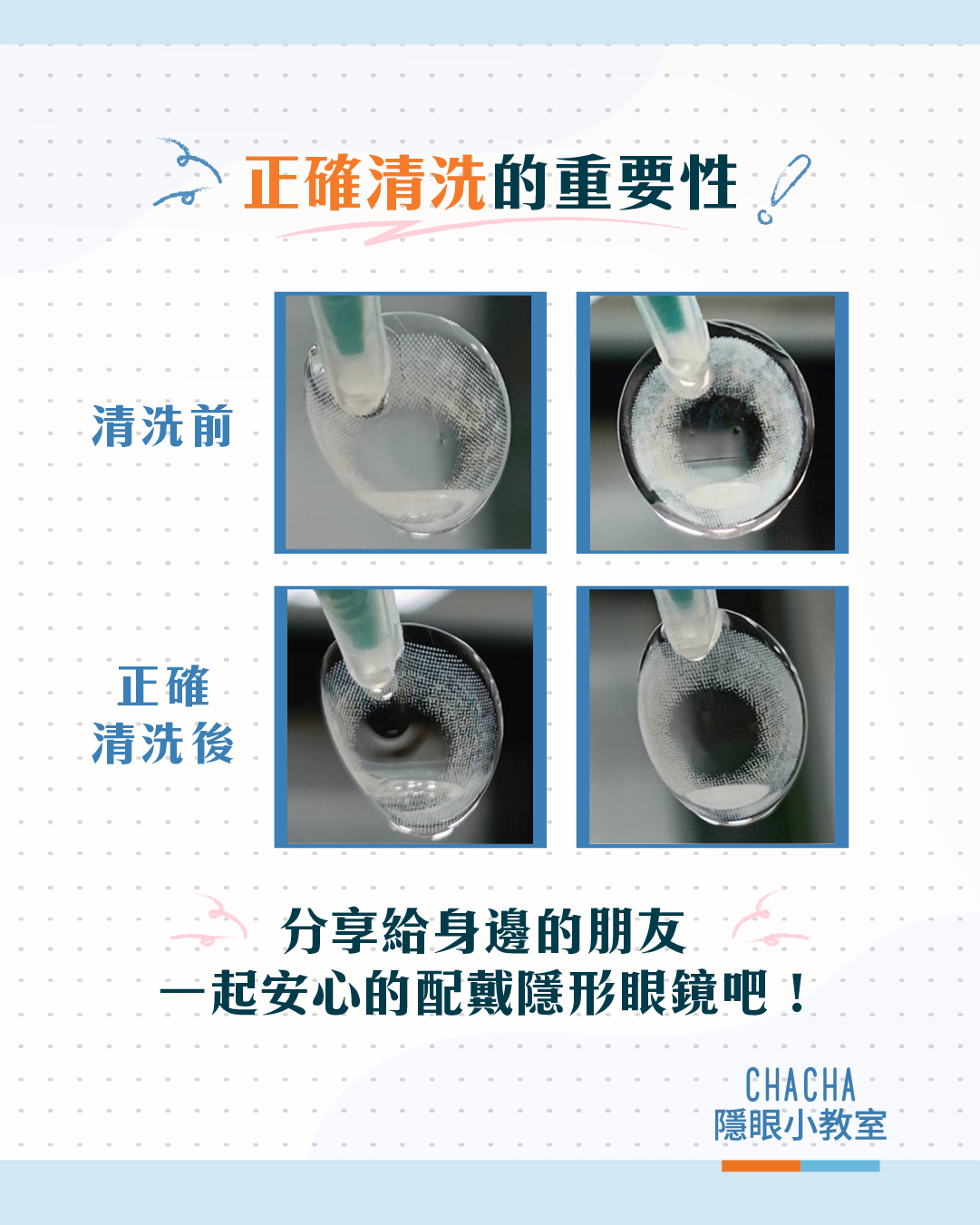正確清洗隱形眼鏡的重要性！清洗前後對比