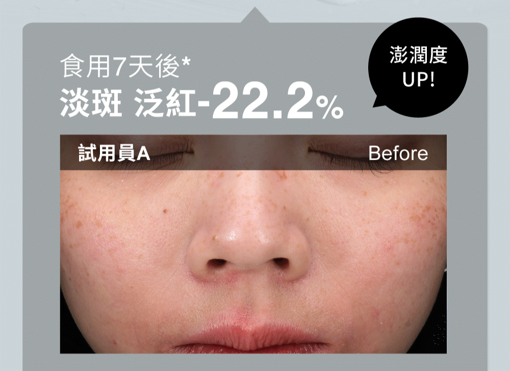 淡斑、泛紅-22.2%，澎潤度UP