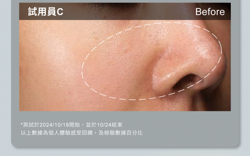 膚色亮白+48%，毛孔問題-51%