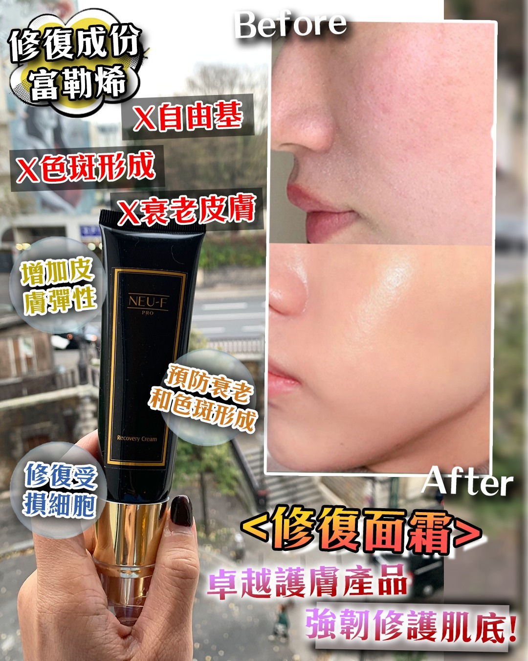 Neu-F Pro Recovery Cream 修復面霜
