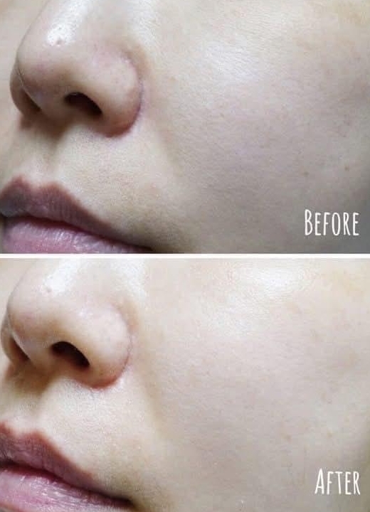 Parkview X Rejuran 麗珠蘭 聯名修復保濕霜 50ml 最優惠開團