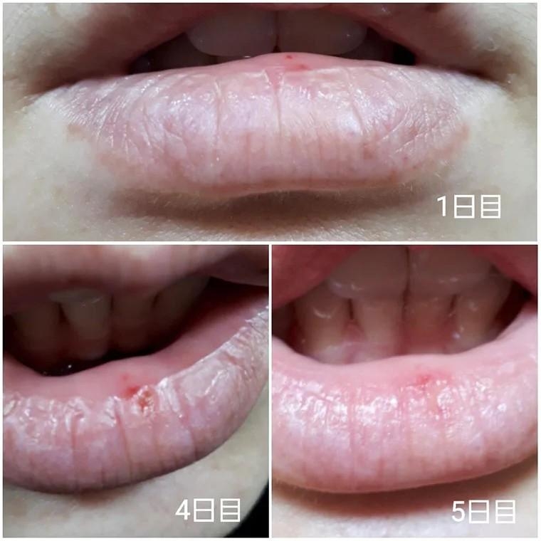 日本口腔 黏膜修復軟膏 5g