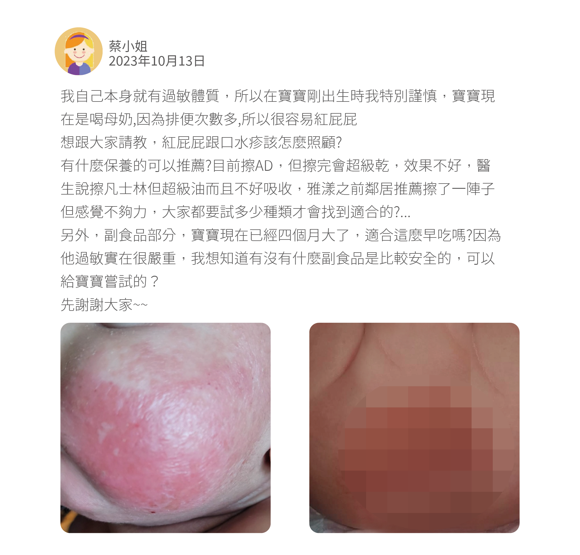 我自己本身就有過敏體質,所以在寶寶剛出生時我特別謹慎,寶寶現在是喝母奶,因為排便次數多,所以很容易紅屁屁 想跟大家請教,紅屁屁跟口水疹該怎麼照顧? 有什麼保養的可以推薦?目前擦AD,但擦完會超級乾,效果不好,醫生說擦凡士林但超級油而且不好吸收,雅漾之前鄰居推薦擦了一陣子但感覺不夠力,大家都要試多少種類才會找到適合的?... 另外,副食品部分,寶寶現在已經四個月大了,適合這麼早吃嗎?因為他過敏實在很嚴重,我想知道有沒有什麼副食品是比較安全的,可以給寶寶嘗試的? 先謝謝大家~~