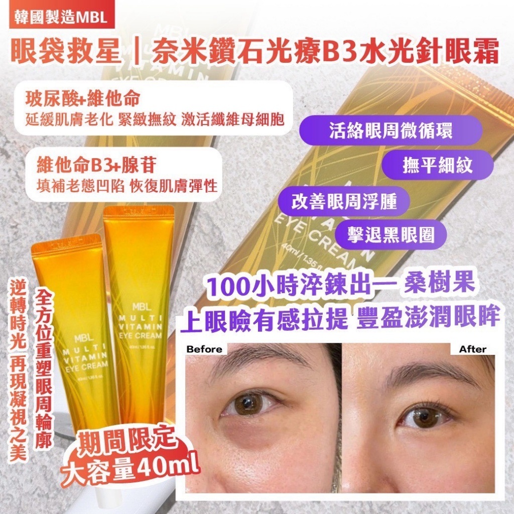 韓國製造MBL ｜眼袋救星｜奈米鑽石光療B3水光針眼霜