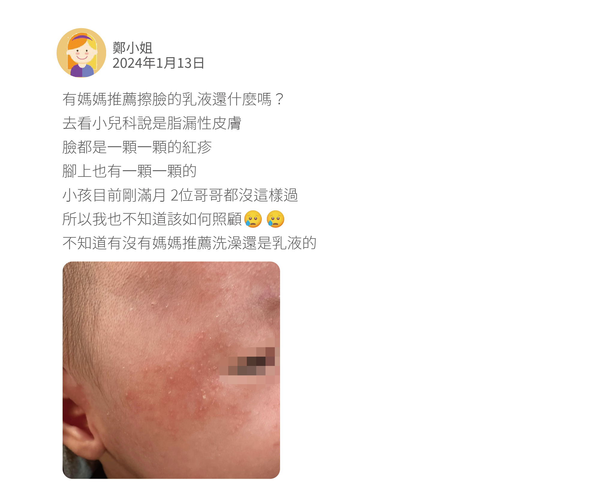 有媽媽推薦擦臉的乳液還什麼嗎? 去看小兒科說是脂漏性皮膚 臉都是一顆一顆的紅疹 腳上也有一顆一顆的 小孩目前剛滿月 2位哥哥都沒這樣過 所以我也不知道該如何照顧 不知道有沒有媽媽推薦洗澡還是乳液的