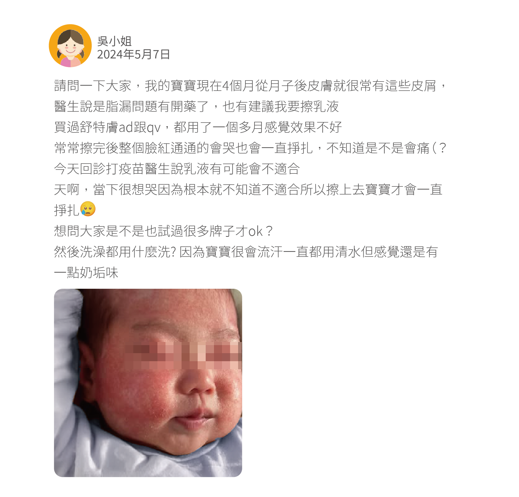 請問一下大家，我的寶寶現在4個月從月子後皮膚就很常有這些皮屑，醫生說是脂漏問題有開藥了，也有建議我要擦乳液 買過舒特膚ad跟qv，都用了一個多月感覺效果不好 常常擦完後整個臉紅通通的會哭也會一直掙扎，不知道是不是會痛（？ 今天回診打疫苗醫生說乳液有可能會不適合 天啊，當下很想哭因為根本就不知道不適合所以擦上去寶寶才會一直掙扎 想問大家是不是也試過很多牌子才ok？ 然後洗澡都用什麼洗? 因為寶寶很會流汗一直都用清水但感覺還是有一點奶垢味