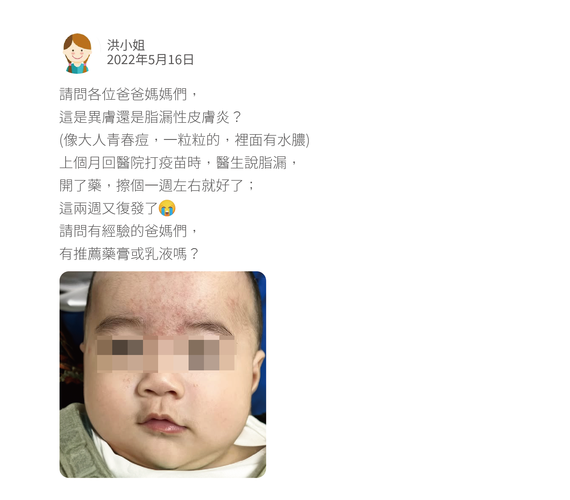 請問各位爸爸媽媽們, 這是異膚還是脂漏性皮膚炎? (像大人青春痘,一粒粒的,裡面有水膿) 上個月回醫院打疫苗時,醫生說脂漏, 開了藥,擦個一週左右就好了; 這兩週又復發了 請問有經驗的爸媽們, 有推薦藥膏或乳液嗎?