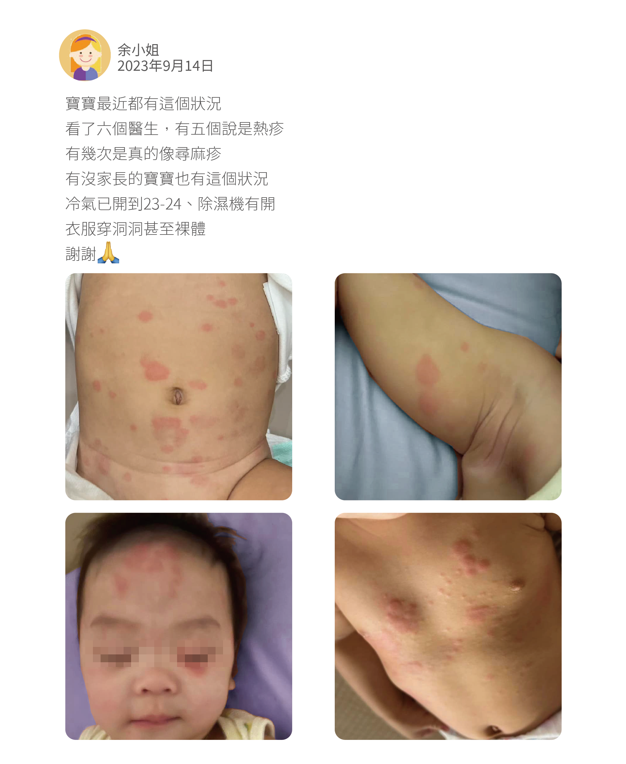 寶寶最近都有這個狀況 看了六個醫生,有五個說是熱疹 有幾次是真的像尋麻疹 有沒家長的寶寶也有這個狀況 冷氣已開到23-24、除濕機有開 衣服穿洞洞甚至裸體 謝謝