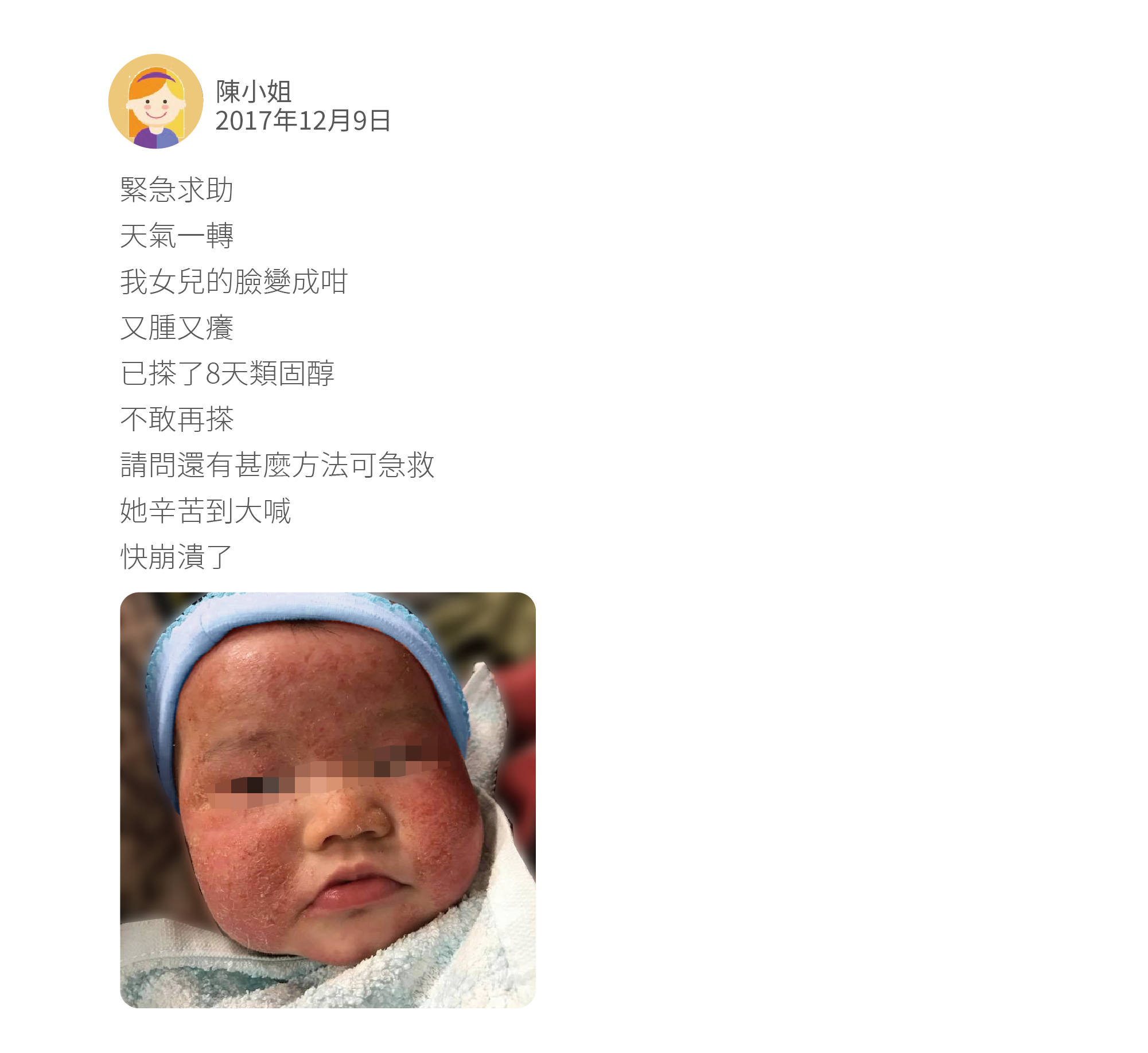 緊急求助 天氣一轉 我女兒的臉變成咁 又腫又癢 已搽了8天類固醇 不敢再搽 請問還有甚麼方法可急救 她辛苦到大喊 快崩潰了