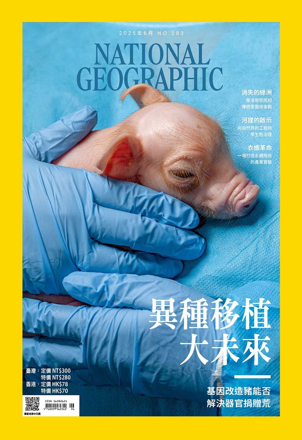 國家地理雜誌_雜誌283期2025年6月號-異種移植大未來-基因改造豬能否解決器官捐贈荒