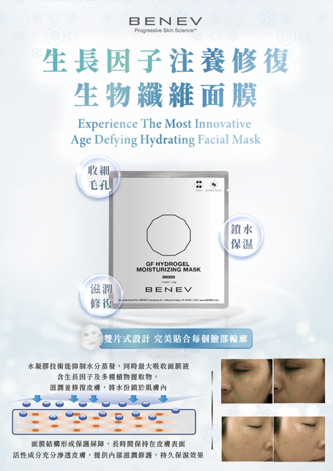 Benev 生長因子注養修復生物纖維面膜 一盒5片 (30g x5pcs)
