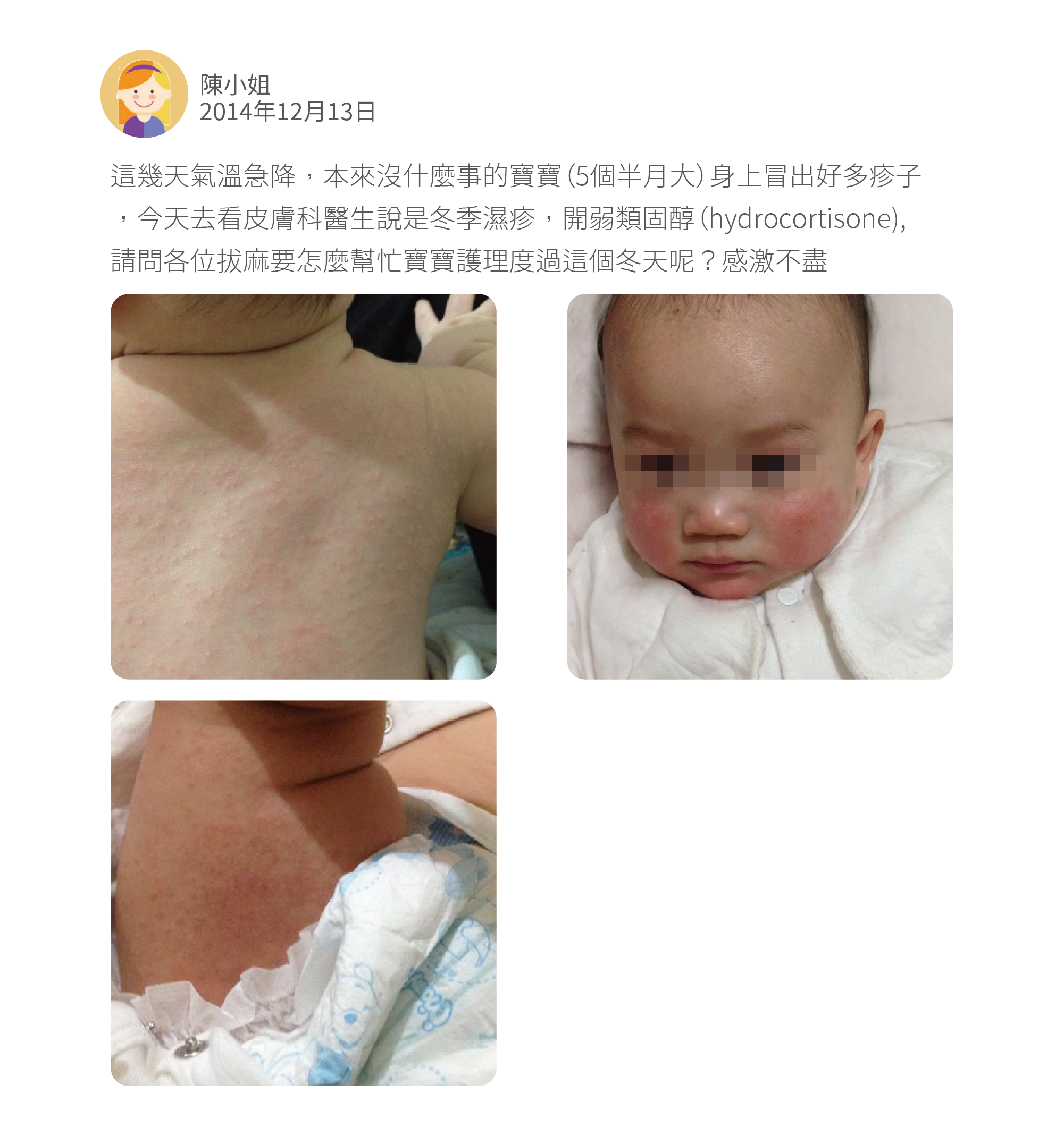 這幾天氣溫急降,本來沒什麼事的寶寶(5個半月大)身上冒出好多疹子,今天去看皮膚科醫生說是冬季濕疹,開弱類固醇(hydrocortisone),請問各位拔麻要怎麼幫忙寶寶護理度過這個冬天呢?感激不盡