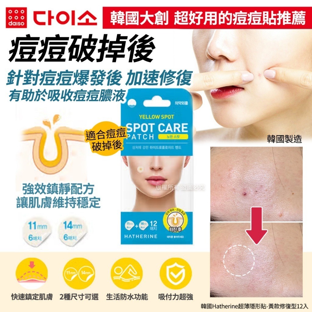 韓國 Hatherine 黃款修復型超薄隱形貼