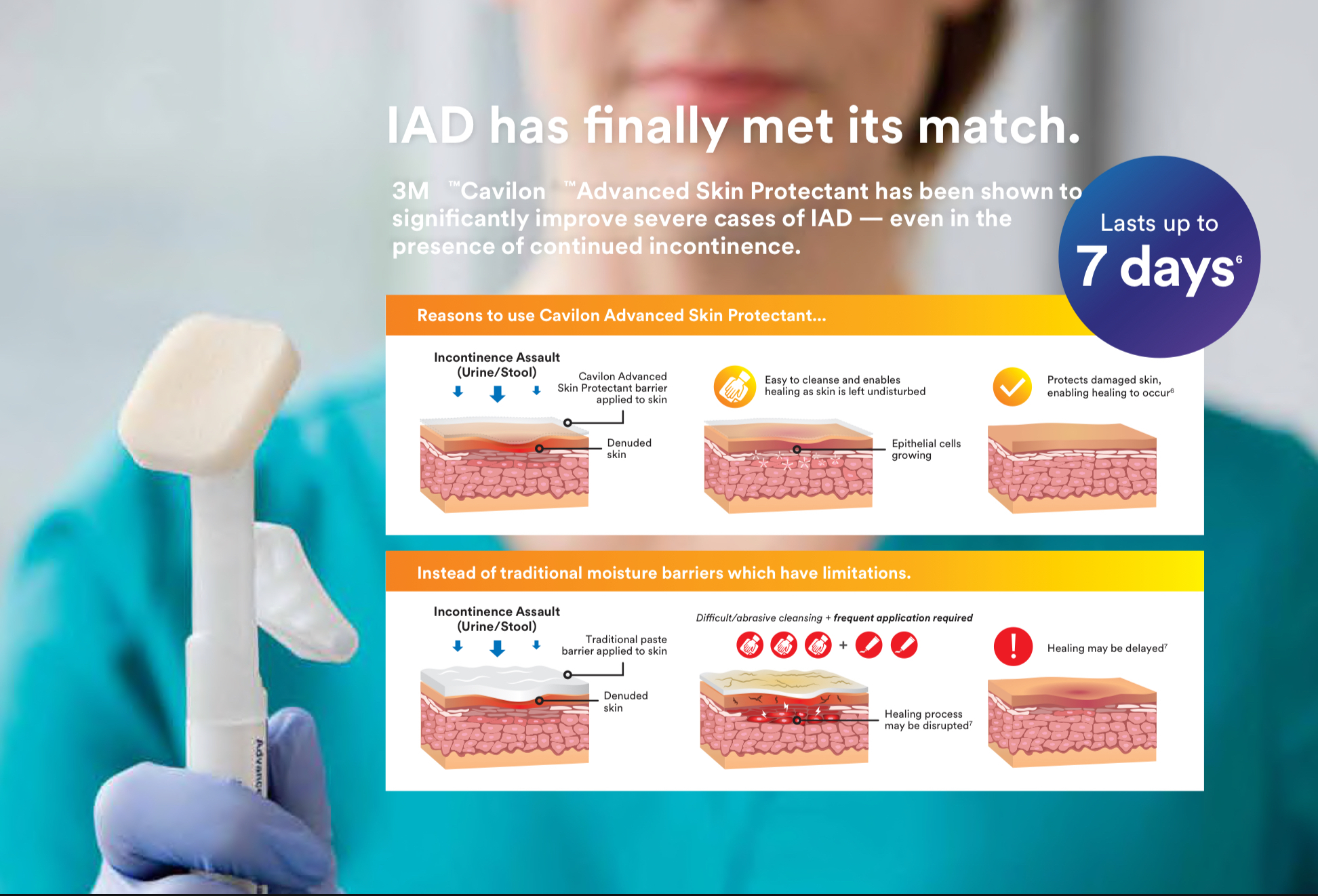 3M Cavilon 高效液體皮膚保護膜