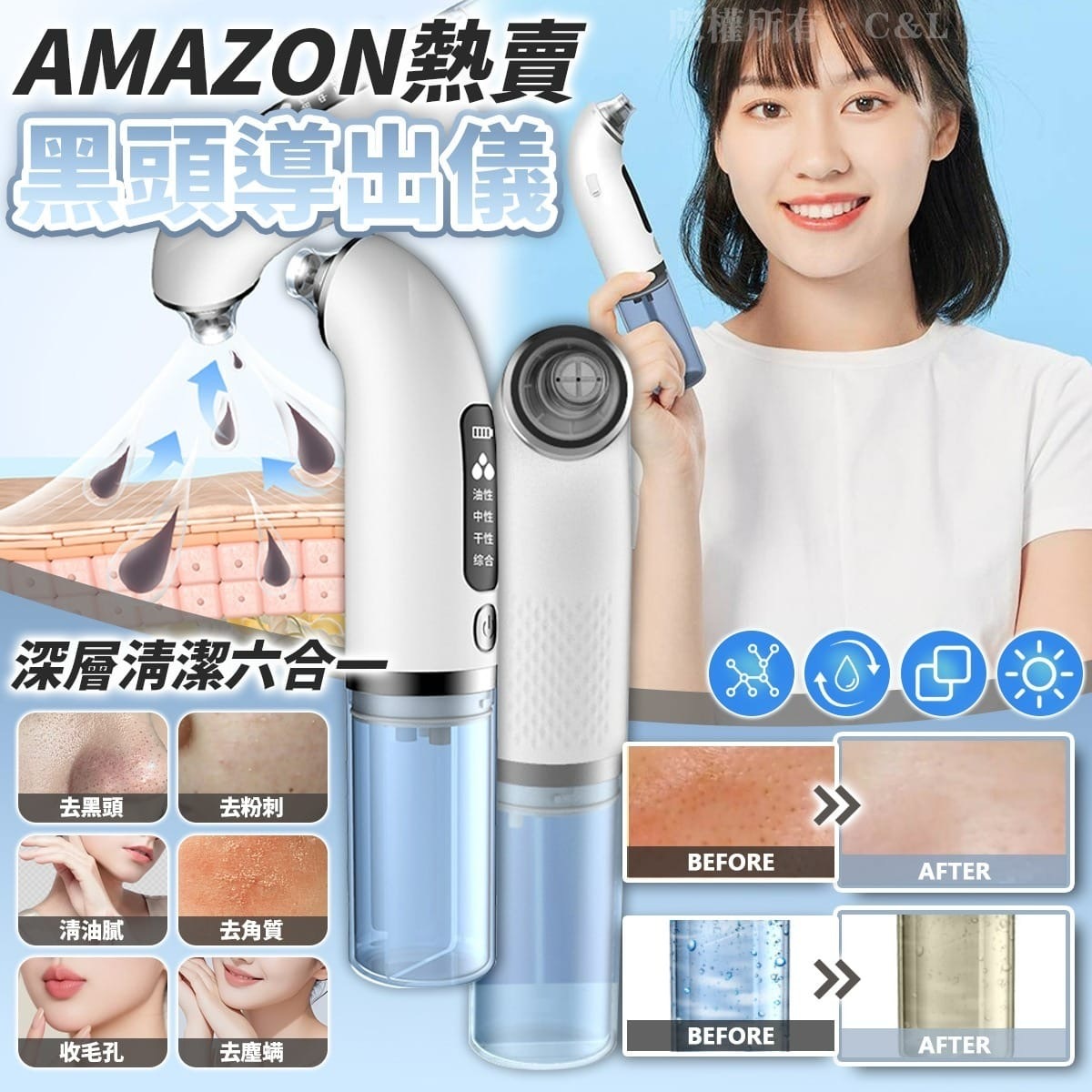 AMAZON熱賣深層清潔六合一黑頭導出儀