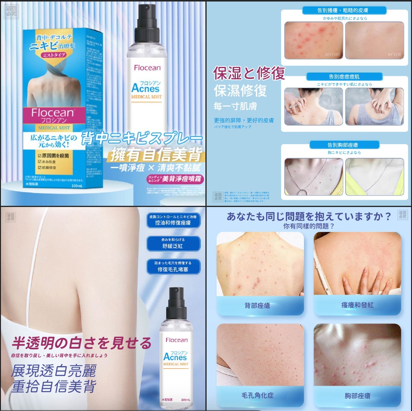 美國暢銷 美背淨痘噴霧(非藥用)