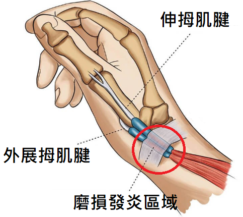 媽媽手圖解