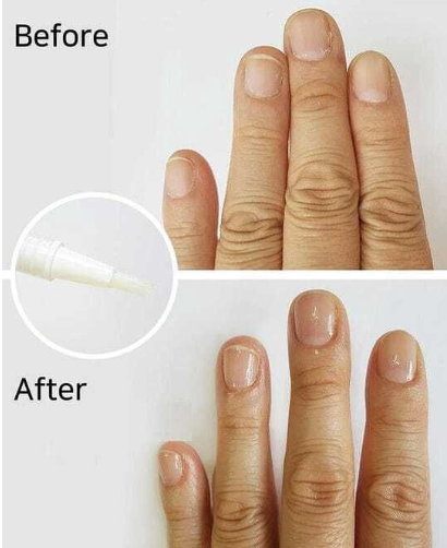 ECHO TOUCH - 韓國 修護指甲 拋光精華液 2ml【向日葵油，堅果油，維他命E 保濕修復】到期日：20270704「L」