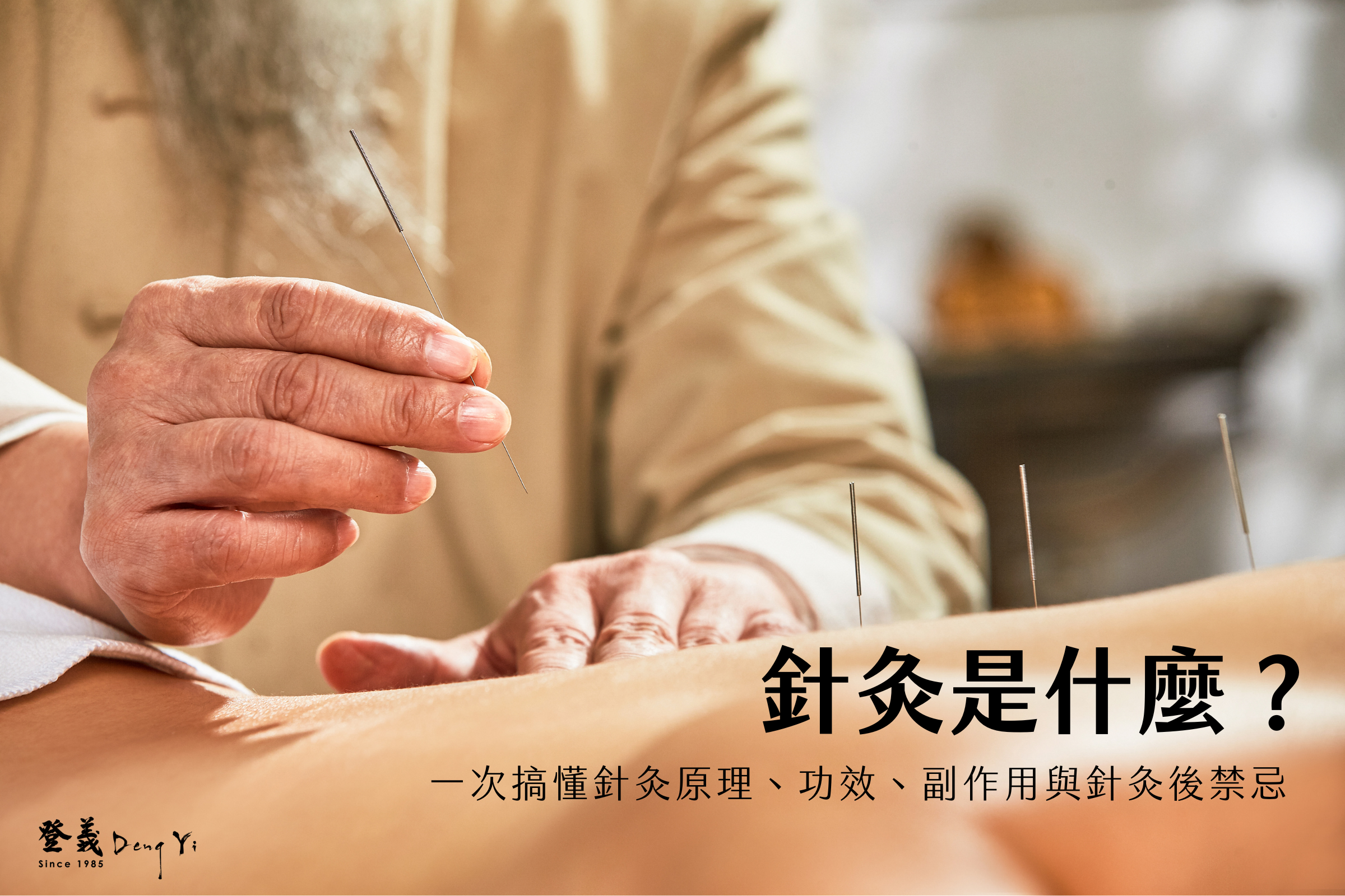 針灸是什麼？一次搞懂針灸原理、功效、副作用與針灸後禁忌