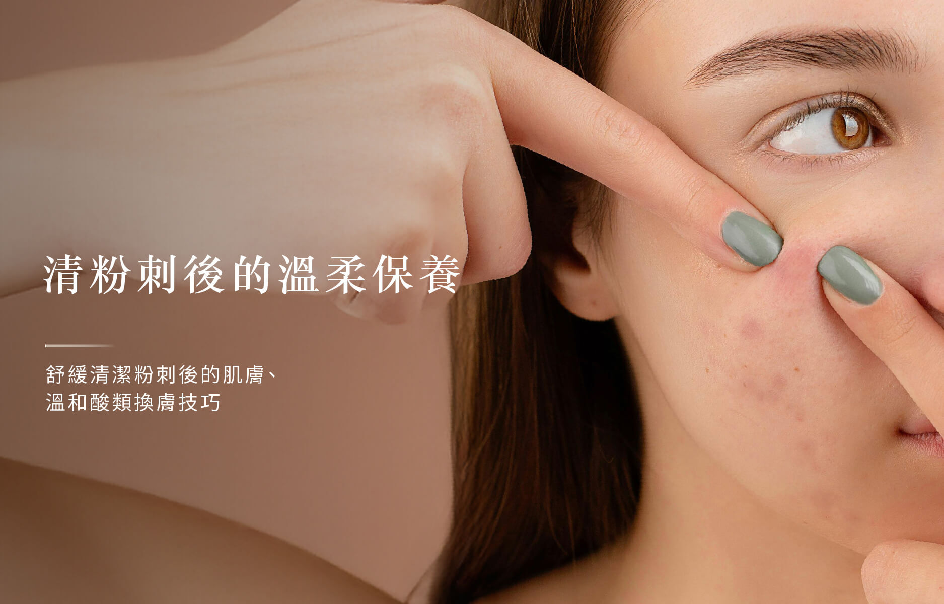 黑頭粉刺怎麼清，清粉刺後怎麼保養