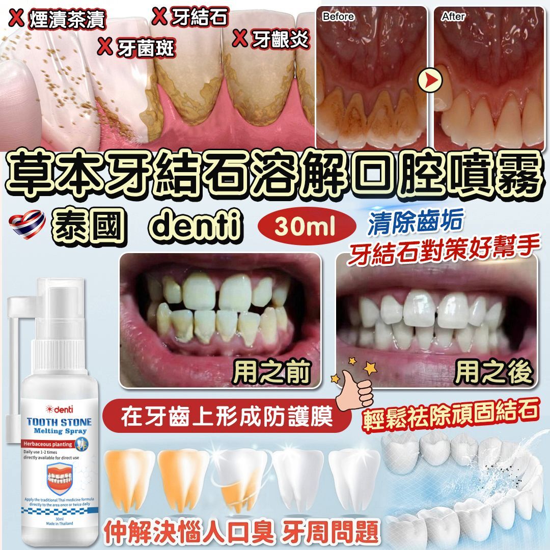 泰國 Denti 草本牙結石溶解口腔噴霧 （1套3支）