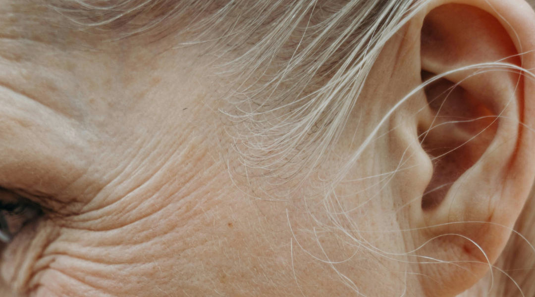 你的臉龐細紋長什麼樣子呢？首先，我們必須了解皺紋生成的8個原因，提早預防對策！接著，我們會跟你們分享7大抗細紋保養策略！最後，  你還是要了解萬一細紋越來越深，那麼，這就是皮膚老化的現象囉！