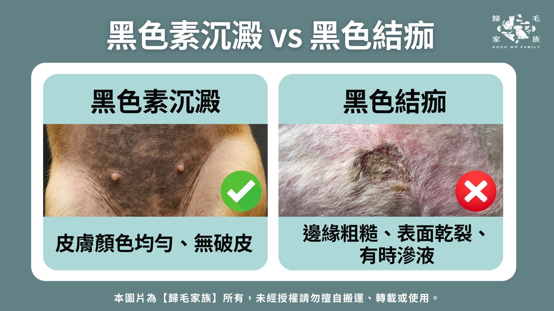 快速對照：黑色結痂與黑色素沉澱怎麼分？