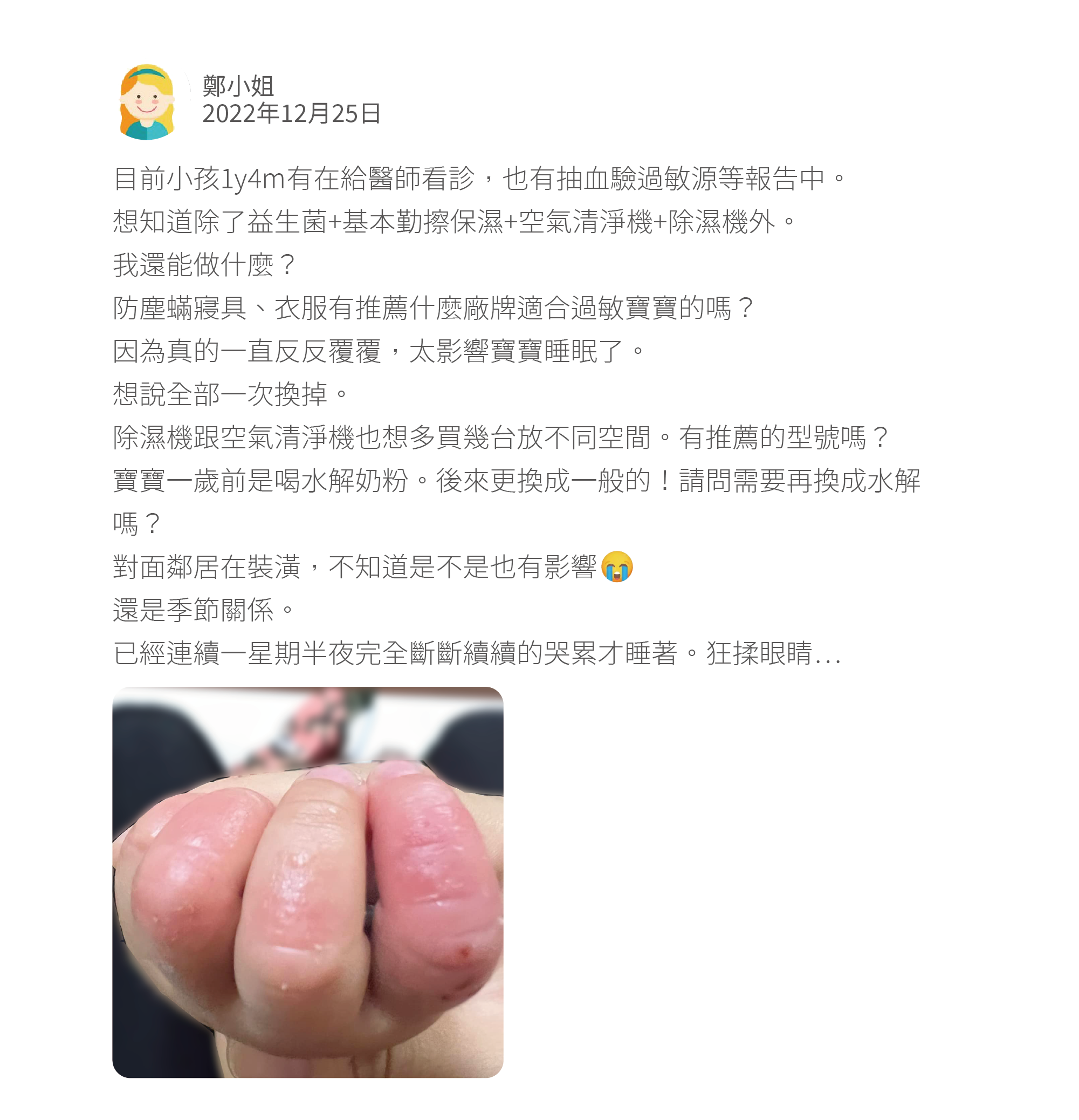 atopic-dermatitis-academy-article-experience-sharing-dyshidrotic-eczema-question8-p2