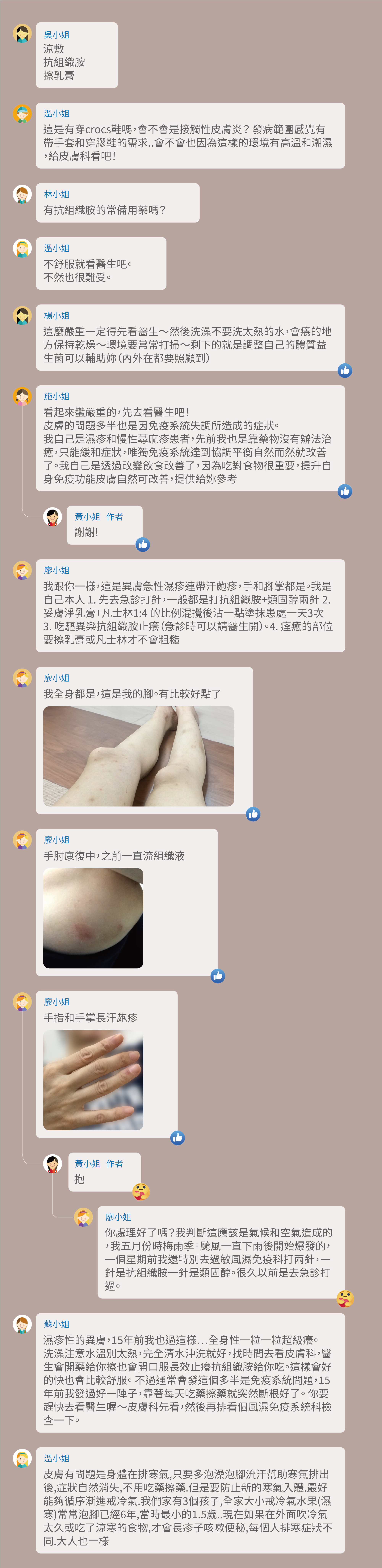 涼敷,抗組織胺,擦乳膏,這是有穿crocs鞋嗎,會不會是接觸性皮膚炎? 發病範圍感覺有帶手套和穿膠鞋的需求..會不會也因為這樣的環境有高溫和潮濕,給皮膚科看吧!有抗組織胺的常備用藥嗎?不舒服就看醫生吧。不然也很難受。這麼嚴重一定得先看醫生~然後洗澡不要洗太熱的水,會癢的地方保持乾燥~環境要常常打掃~剩下的就是調整自己的體質益生菌可以輔助妳(內外在都要照顧到),看起來蠻嚴重的,先去看醫生吧!皮膚的問題多半也是因免疫系統失調所造成的症狀。我自己是濕疹和慢性蕁麻疹患者,先前我也是靠藥物沒有辦法治癒,只能緩和症狀,唯獨免疫系統達到協調平衡自然而然就改善了。我自己是透過改變飲食改善了,因為吃對食物很重要,提升自身免疫功能皮膚自然可改善,提供給妳參考,我跟你一樣,這是異膚急性濕疹連帶汗皰疹,手和腳掌都是。我是自己本人 1. 先去急診打針,一般都是打抗組織胺+類固醇兩針 2. 妥膚淨乳膏+凡士林1:4 的比例混攪後沾一點塗抹患處一天3次 3. 吃驅異樂抗組織胺止癢(急診時可以請醫生開)。4. 痊癒的部位要擦乳膏或凡士林才不會粗糙,我全身都是,這是我的腳。有比較好點了,手肘康復中,之前一直流組織液,手指和手掌長汗皰疹,你處理好了嗎?我判斷這應該是氣候和空氣造成的,我五月份時梅雨季+颱風一直下雨後開始爆發的,一個星期前我還特別去過敏風濕免疫科打兩針,一針是抗組織胺一針是類固醇。很久以前是去急診打過。濕疹性的異膚,15年前我也過這樣⋯全身性一粒一粒超級癢。洗澡注意水溫別太熱,完全清水沖洗就好,找時間去看皮膚科,醫生會開藥給你擦也會開口服長效止癢抗組織胺給你吃。這樣會好的快也會比較舒服。 不過通常會發這個多半是免疫系統問題,15年前我發過好一陣子,靠著每天吃藥擦藥就突然斷根好了。 你要趕快去看醫生喔~皮膚科先看,然後再排看個風濕免疫系統科檢查一下。皮膚有問題是身體在排寒氣,只要多泡澡泡腳流汗幫助寒氣排出後,症狀自然消失,不用吃藥擦藥.但是要防止新的寒氣入體.最好能夠循序漸進戒冷氣.我們家有3個孩子,全家大小戒冷氣水果(濕寒)常常泡腳已經6年,當時最小的1.5歲..現在如果在外面吹冷氣太久或吃了涼寒的食物,才會長疹子咳嗽便秘,每個人排寒症狀不同.大人也一樣