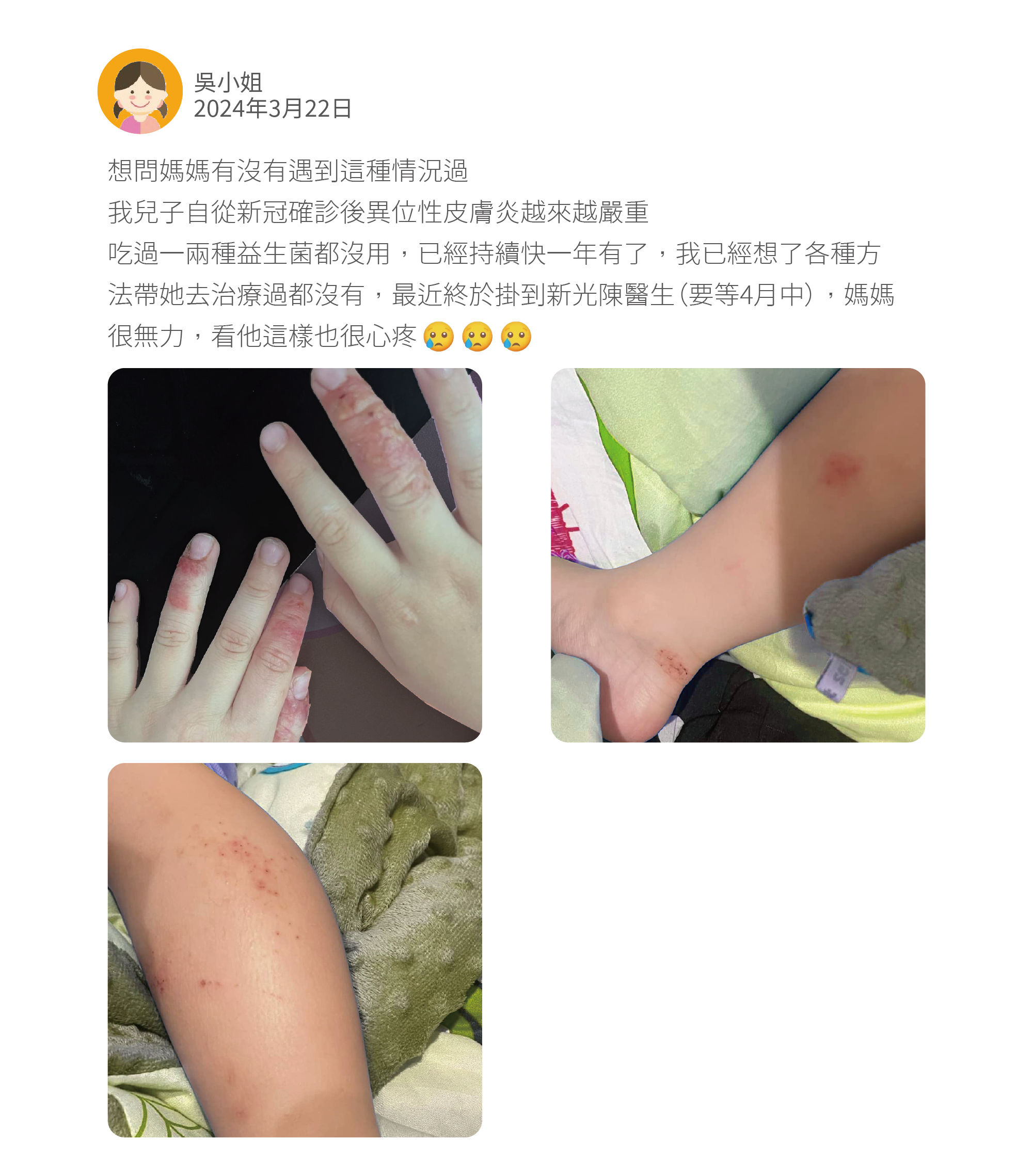 想問媽媽有沒有遇到這種情況過 我兒子自從新冠確診後異位性皮膚炎越來越嚴重 吃過一兩種益生菌都沒用，已經持續快一年有了，我已經想了各種方法帶她去治療過都沒有，最近終於掛到新光陳醫生（要等4月中），媽媽很無力，看他這樣也很心疼