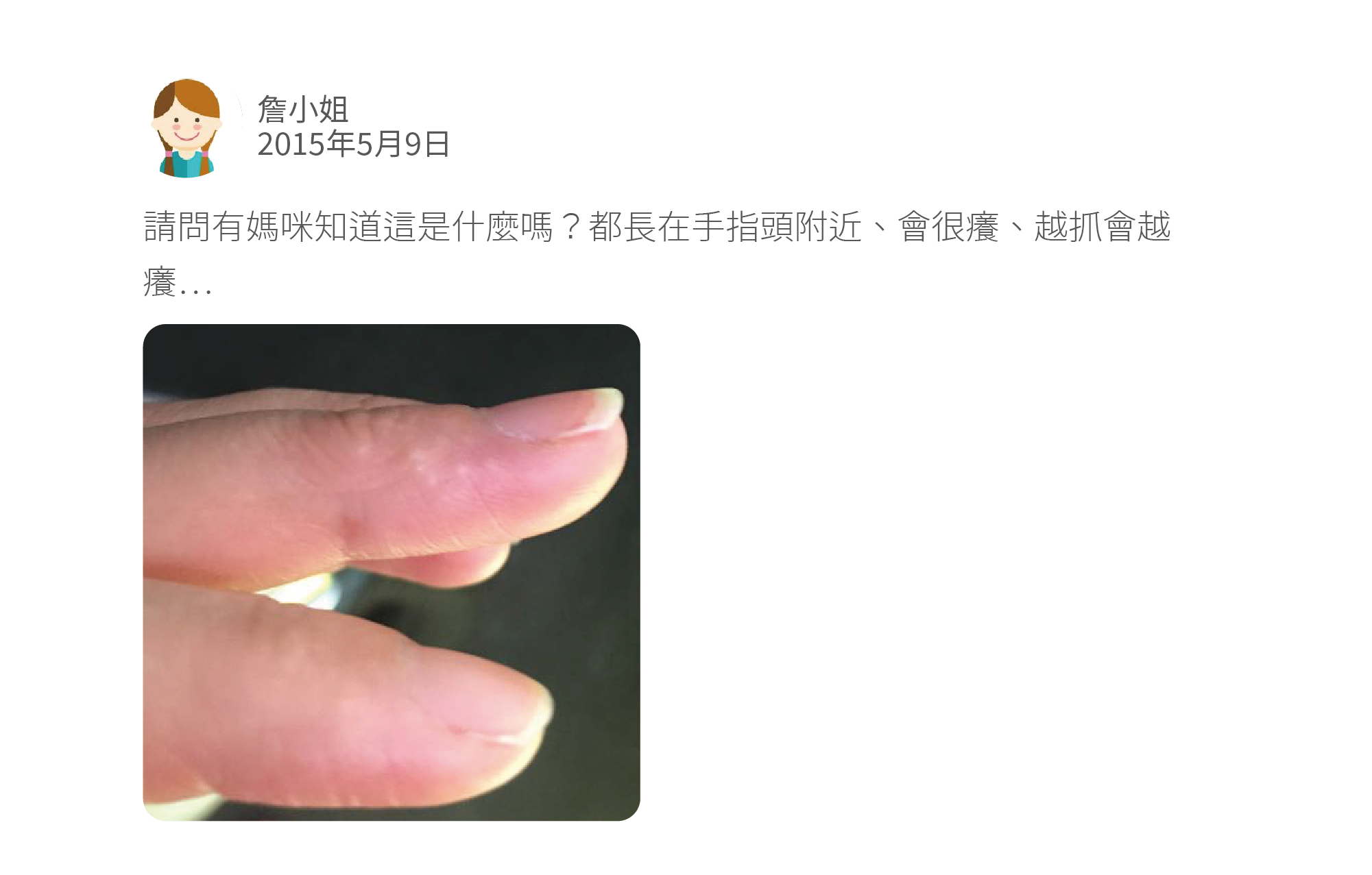 請問有媽咪知道這是什麼嗎?都長在手指頭附近、會很癢、越抓會越癢⋯