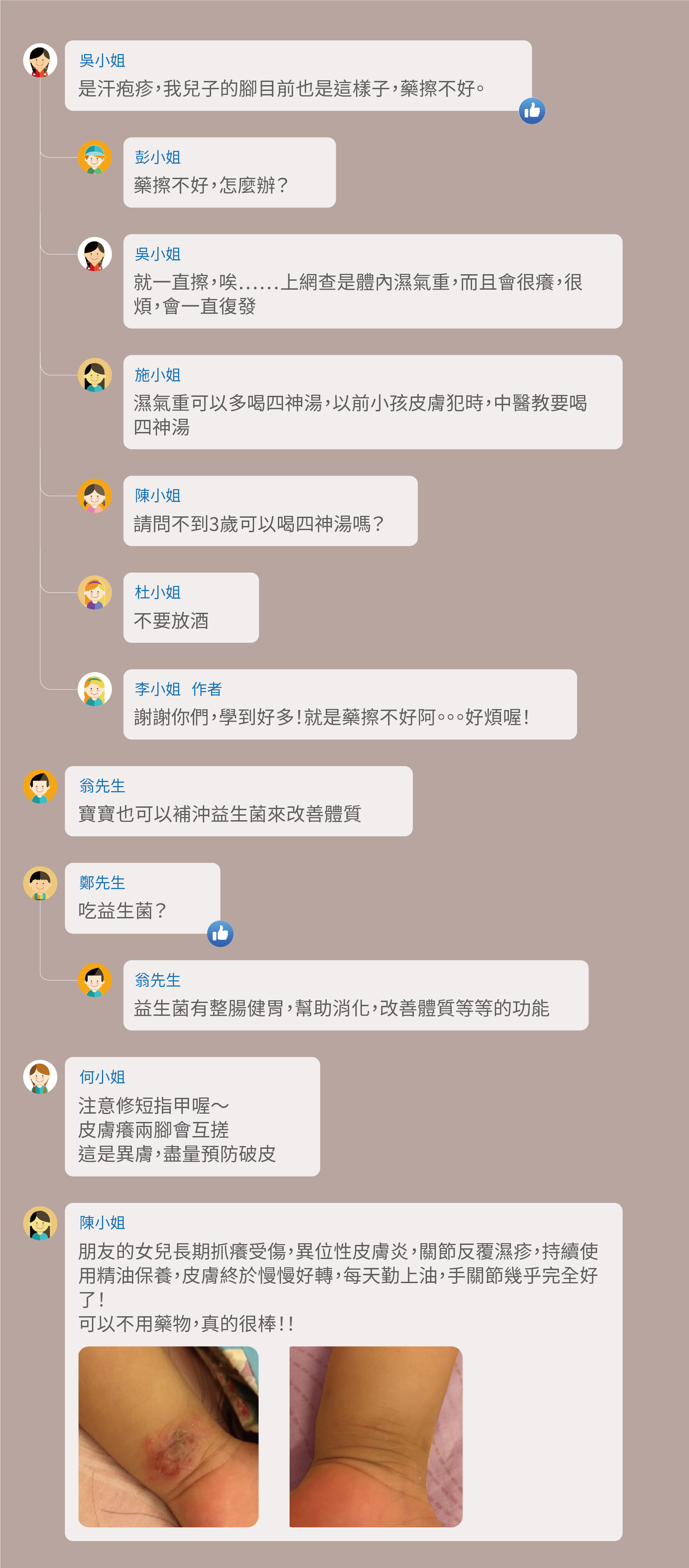 是汗疱疹,我兒子的腳目前也是這樣子,藥擦不好。藥擦不好,怎麼辦?就一直擦,唉……上網查是體內濕氣重,而且會很癢,很煩,會一直復發,濕氣重可以多喝四神湯,以前小孩皮膚犯時,中醫教要喝四神湯,請問不到3歲可以喝四神湯嗎?不要放酒,謝謝你們,學到好多!就是藥擦不好阿。。。好煩喔!寶寶也可以補沖益生菌來改善體質,吃益生菌?益生菌有整腸健胃,幫助消化,改善體質等等的功能,注意修短指甲喔~皮膚癢兩腳會互搓,這是異膚,盡量預防破皮,朋友的女兒長期抓癢受傷,異位性皮膚炎,關節反覆濕疹,持續使用精油保養,皮膚終於慢慢好轉,每天勤上油,手關節幾乎完全好了! 可以不用藥物,真的很棒!!