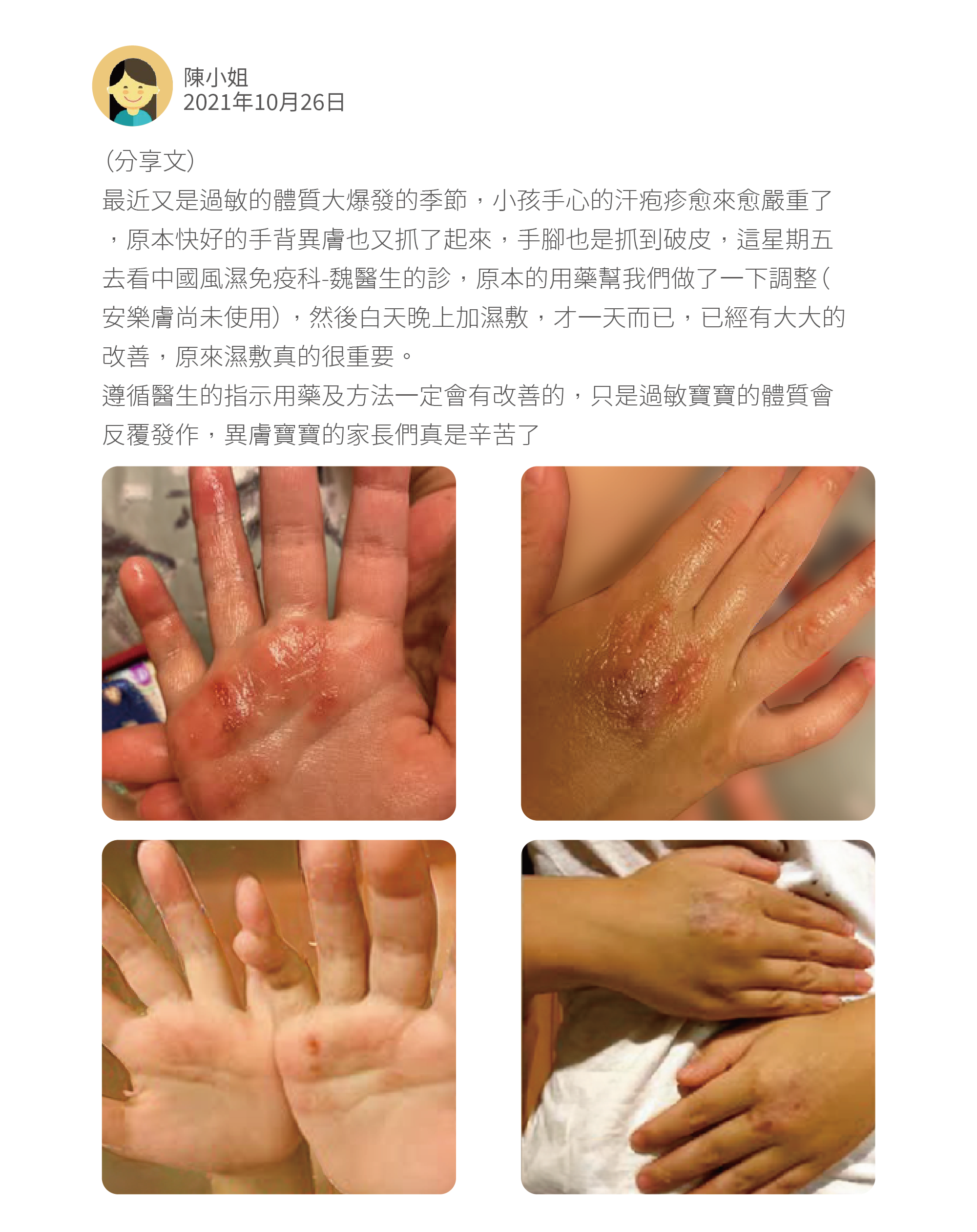 (分享文) 最近又是過敏的體質大爆發的季節,小孩手心的汗疱疹愈來愈嚴重了,原本快好的手背異膚也又抓了起來,手腳也是抓到破皮,這星期五去看中國風濕免疫科-魏醫生的診,原本的用藥幫我們做了一下調整(安樂膚尚未使用),然後白天晚上加濕敷,才一天而已,已經有大大的改善,原來濕敷真的很重要。 遵循醫生的指示用藥及方法一定會有改善的,只是過敏寶寶的體質會反覆發作,異膚寶寶的家長們真是辛苦了