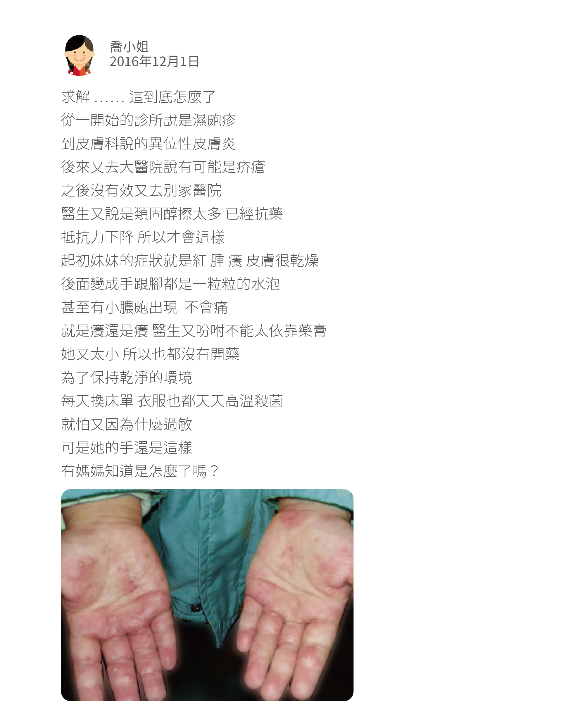 求解 …… 這到底怎麼了 從一開始的診所說是濕皰疹 到皮膚科說的異位性皮膚炎 後來又去大醫院說有可能是疥瘡 之後沒有效又去別家醫院 醫生又說是類固醇擦太多 已經抗藥 抵抗力下降 所以才會這樣 起初妹妹的症狀就是紅 腫 癢 皮膚很乾燥 後面變成手跟腳都是一粒粒的水泡 甚至有小膿皰出現 不會痛 就是癢還是癢 醫生又吩咐不能太依靠藥膏 她又太小 所以也都沒有開藥 為了保持乾淨的環境 每天換床單 衣服也都天天高溫殺菌 就怕又因為什麼過敏 可是她的手還是這樣 有媽媽知道是怎麼了嗎?