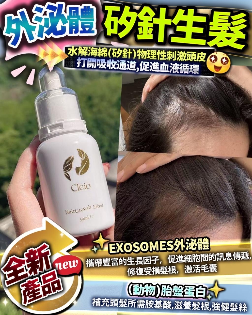 💥外泌體矽針生髮王 50ml