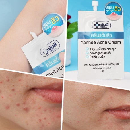 Yanhee - 泰國高效調理暗瘡膏 7g (T6 T640)