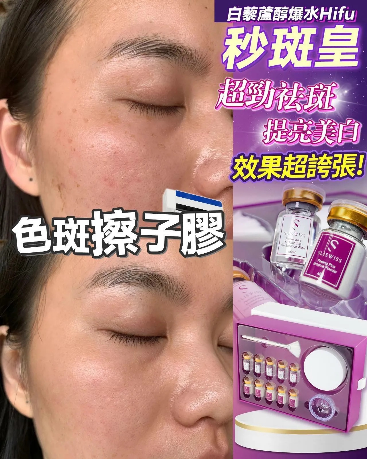 sliswiss hifu 秒斑皇面膜套裝