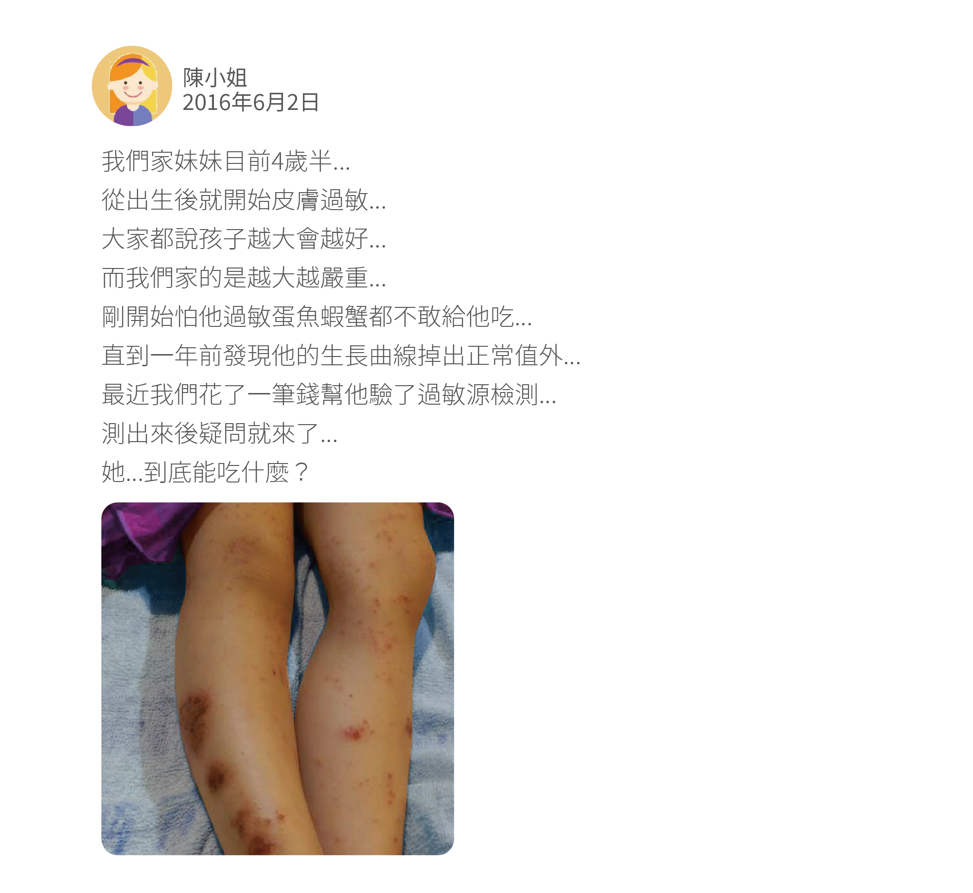我們家妹妹目前4歲半... 從出生後就開始皮膚過敏... 大家都說孩子越大會越好... 而我們家的是越大越嚴重... 剛開始怕他過敏蛋魚蝦蟹都不敢給他吃... 直到一年前發現他的生長曲線掉出正常值外... 最近我們花了一筆錢幫他驗了過敏源檢測... 測出來後疑問就來了... 她...到底能吃什麼？