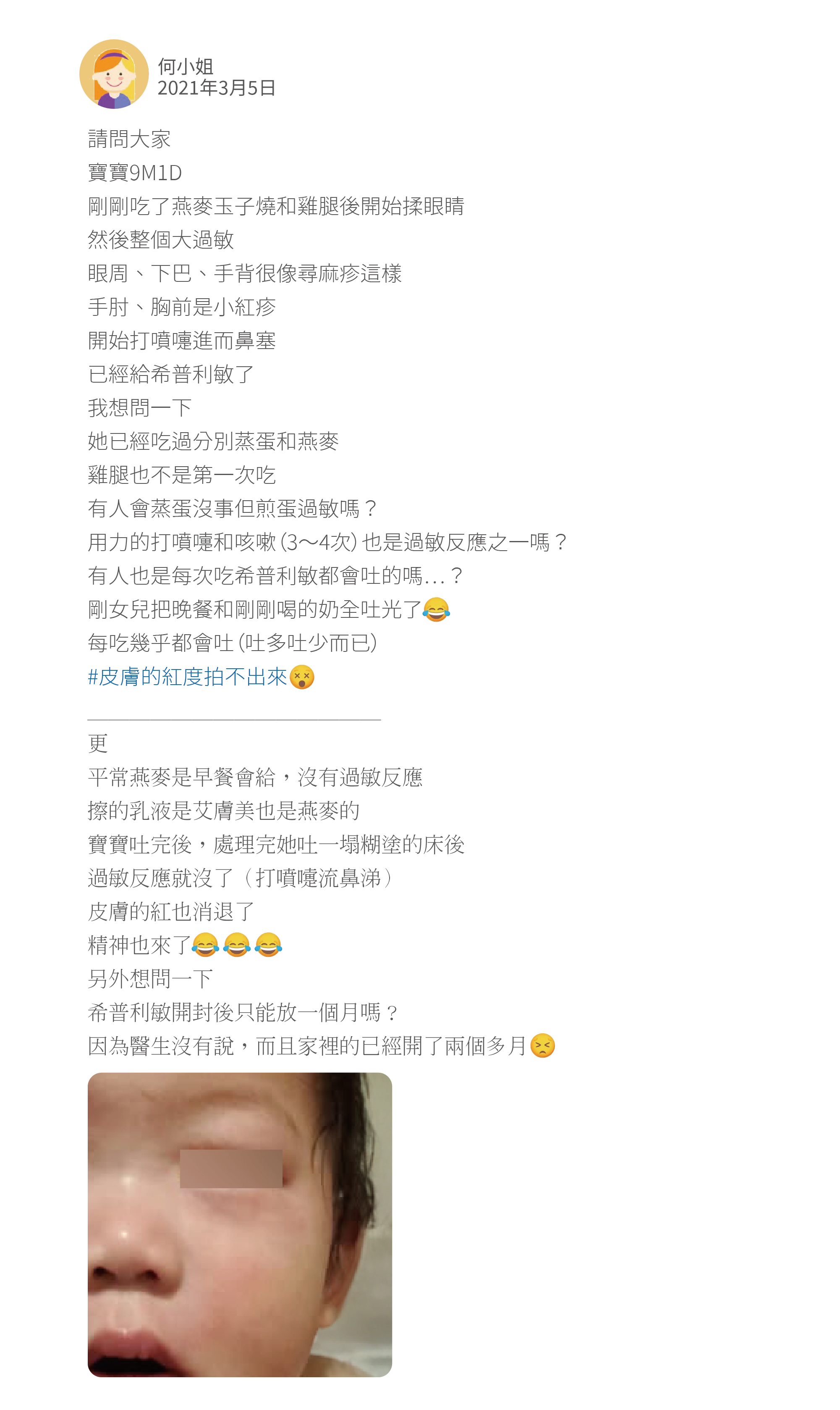 請問大家 寶寶9M1D 剛剛吃了燕麥玉子燒和雞腿後開始揉眼睛 然後整個大過敏 眼周、下巴、手背很像尋麻疹這樣 手肘、胸前是小紅疹 開始打噴嚏進而鼻塞 已經給希普利敏了 我想問一下 她已經吃過分別蒸蛋和燕麥 雞腿也不是第一次吃 有人會蒸蛋沒事但煎蛋過敏嗎? 用力的打噴嚏和咳嗽(3~4次)也是過敏反應之一嗎? 有人也是每次吃希普利敏都會吐的嗎…? 剛女兒把晚餐和剛剛喝的奶全吐光了 每吃幾乎都會吐(吐多吐少而已) #皮膚的紅度拍不出來 ______________ 更 平常燕麥是早餐會給,沒有過敏反應 擦的乳液是艾膚美也是燕麥的 寶寶吐完後,處理完她吐一塌糊塗的床後 過敏反應就沒了(打噴嚏流鼻涕) 皮膚的紅也消退了 精神也來了 另外想問一下 希普利敏開封後只能放一個月嗎? 因為醫生沒有說,而且家裡的已經開了兩個多月