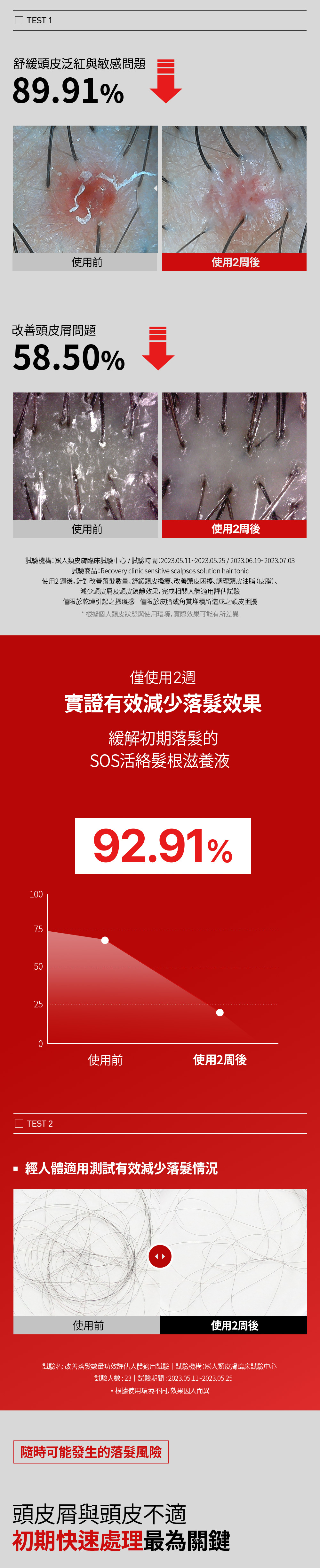 SOS 活絡髮根滋養液120ml_02