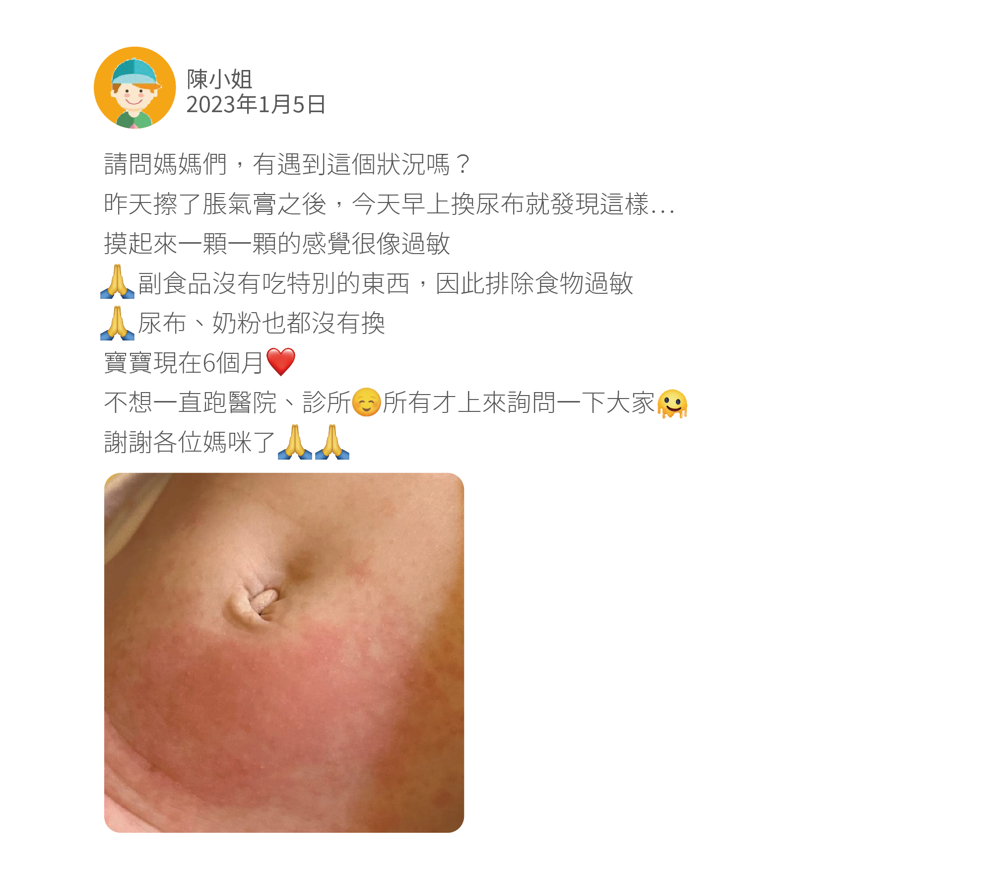 請問媽媽們，有遇到這個狀況嗎？ 昨天擦了脹氣膏之後，今天早上換尿布就發現這樣⋯ 摸起來一顆一顆的感覺很像過敏      副食品沒有吃特別的東西，因此排除食物過敏      尿布、奶粉也都沒有換 寶寶現在6個月 不想一直跑醫院、診所     所有才上來詢問一下大家 謝謝各位媽咪了