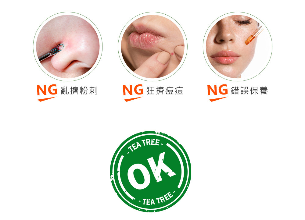 NARUKO 牛爾茶樹抗痘粉刺寶 30ml