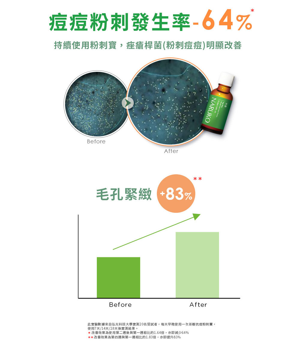 NARUKO牛爾 茶樹抗痘粉刺寶30ml