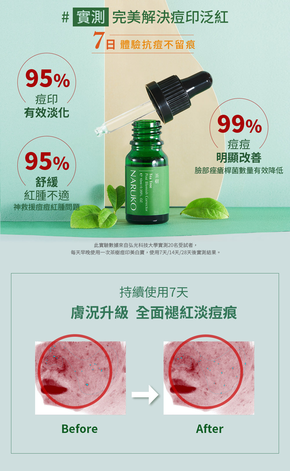 NARUKO牛爾 茶樹痘印美白寶10ml