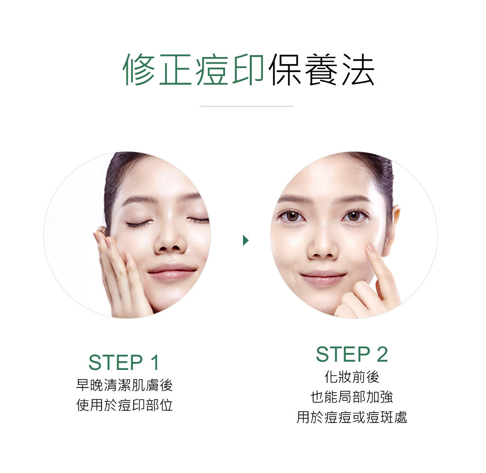 NARUKO牛爾 茶樹痘印美白寶10ml