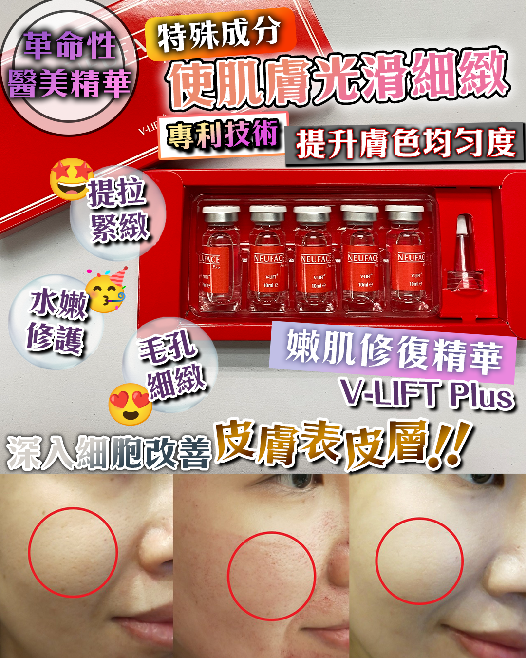 Neuface Pro v-lift+（買一送一，共兩盒）