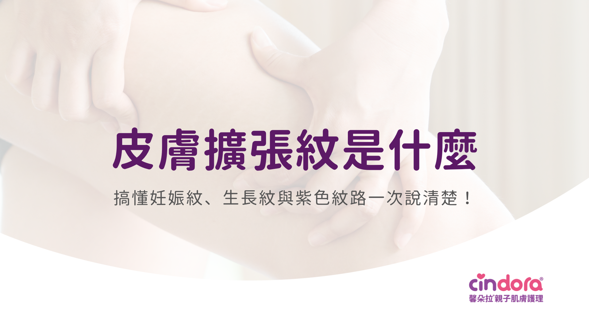 皮膚擴張紋是什麼