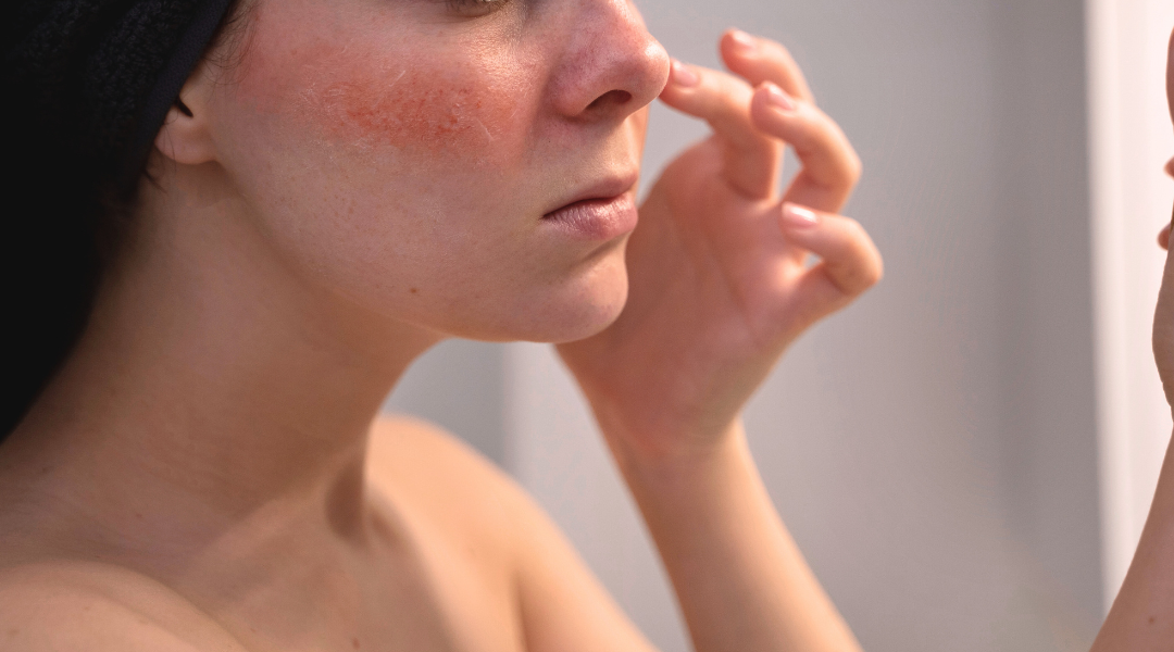 為什麼喝很多水，皮膚還是乾？ Ans（1）：除了補水，還需要補充 Omega-3、維生素 C、膠原蛋白，並搭配外部保濕！