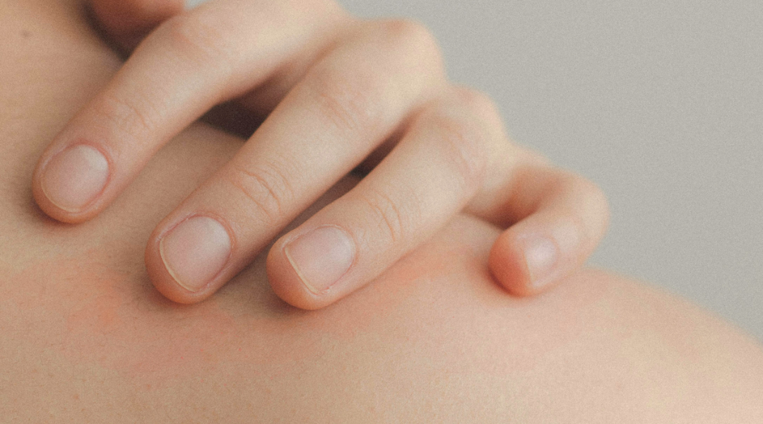 皮膚刺痛灼熱怎麼辦？你的皮膚是否曾突然出現刺痛感，甚至伴隨紅腫、乾癢、灼熱或脫皮？這種不適感可能與皮膚屏障受損、氣候變化、過敏、神經性問題等多種因素有關。若長期忽視，可能會導致更嚴重的肌膚問題，如慢性發炎或皮膚病變。